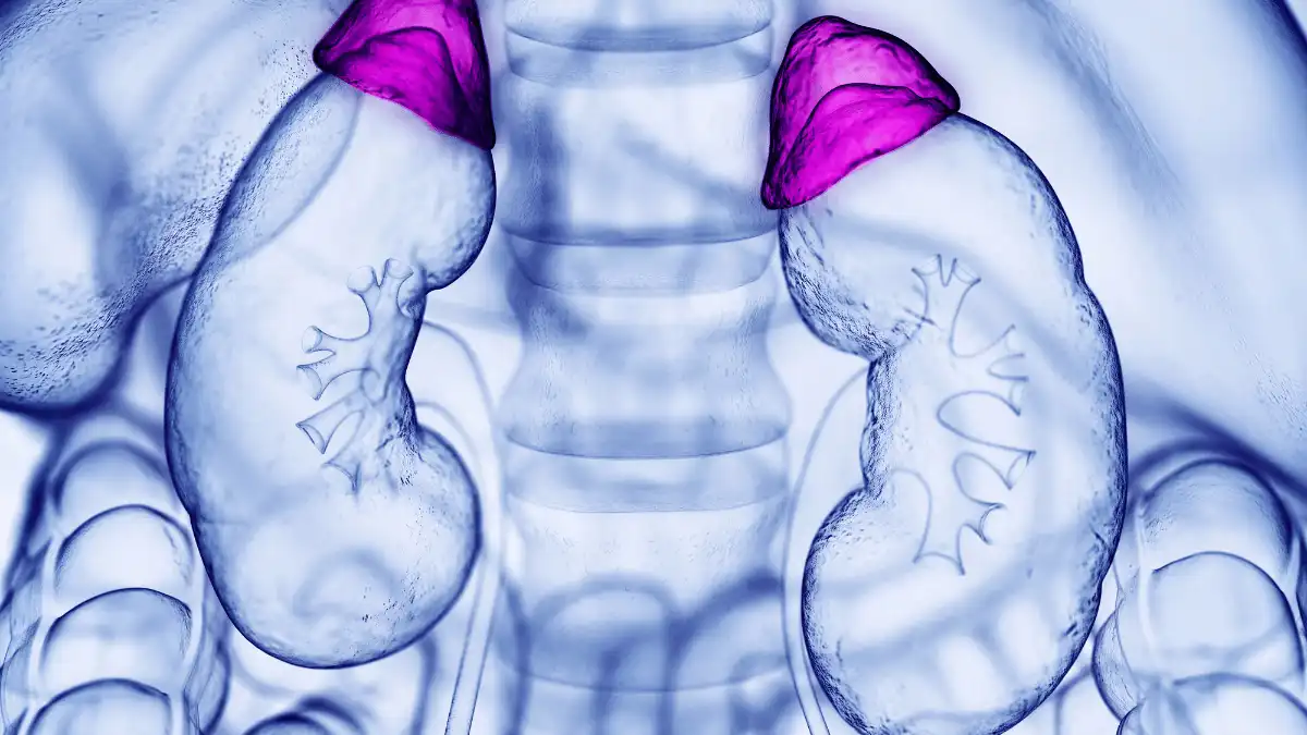 Adenoma adrenal
