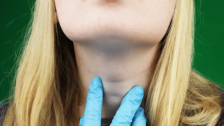 Sintomas de hipotireoidismo na mulher