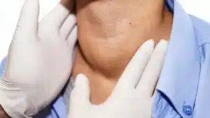 Bócio